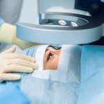 عمل لیزیک چشم برای چه کسانی مناسب است؟